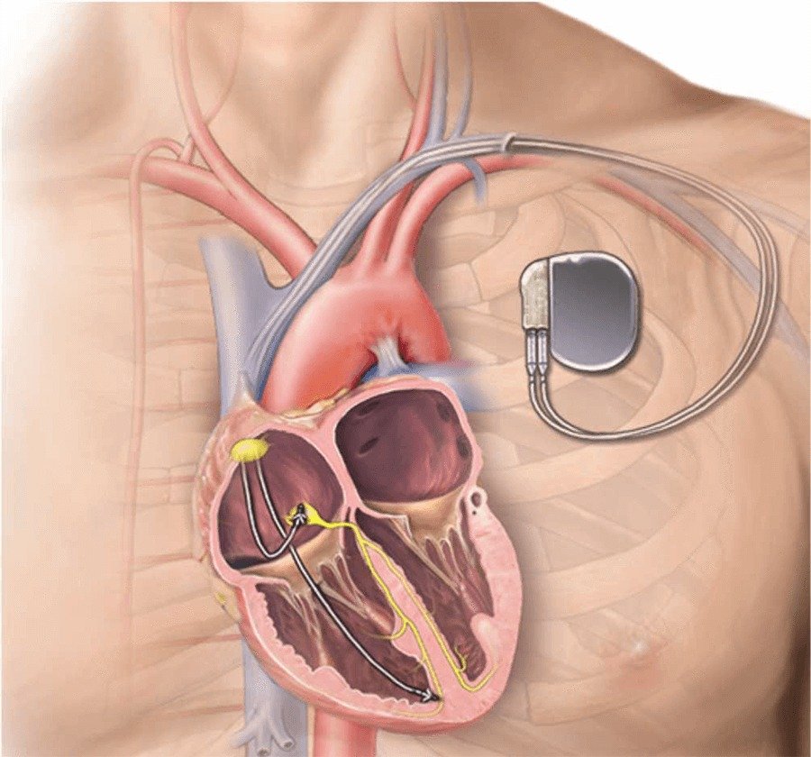 Cardiological Society of India (CSI): Advancing Heart Health Across India